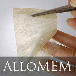 allomem image